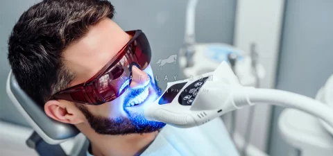 Teeth Whitening in Turkey