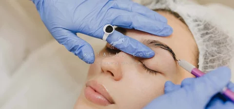 Eyebrow Transplant in Turkey